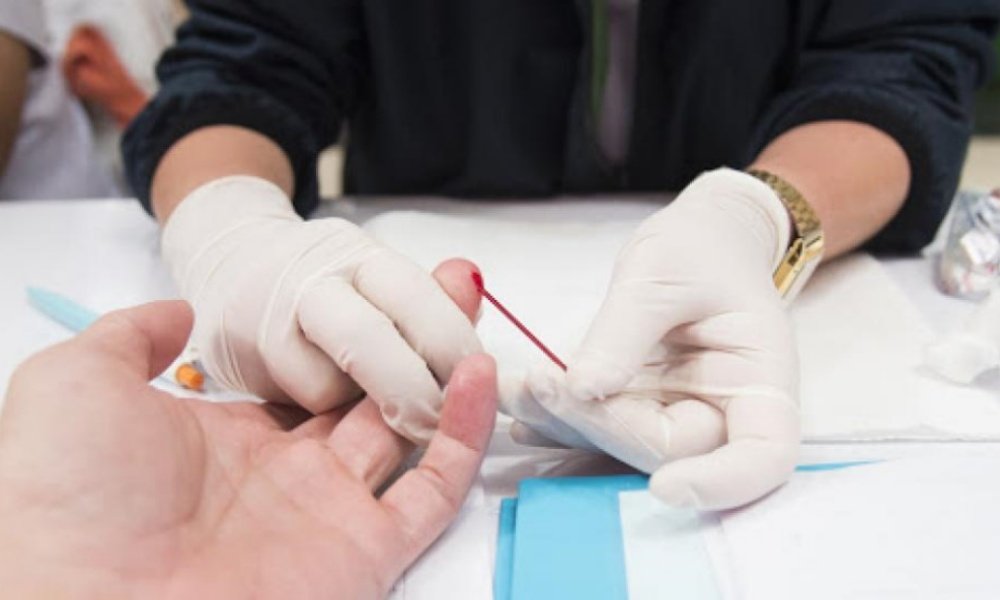 Mão masculina espalmada para coleta de sangue para teste rápido de detecção do HIV.